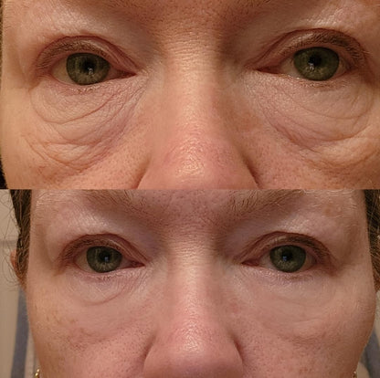 Instant Eye Firming & Tightening Cream